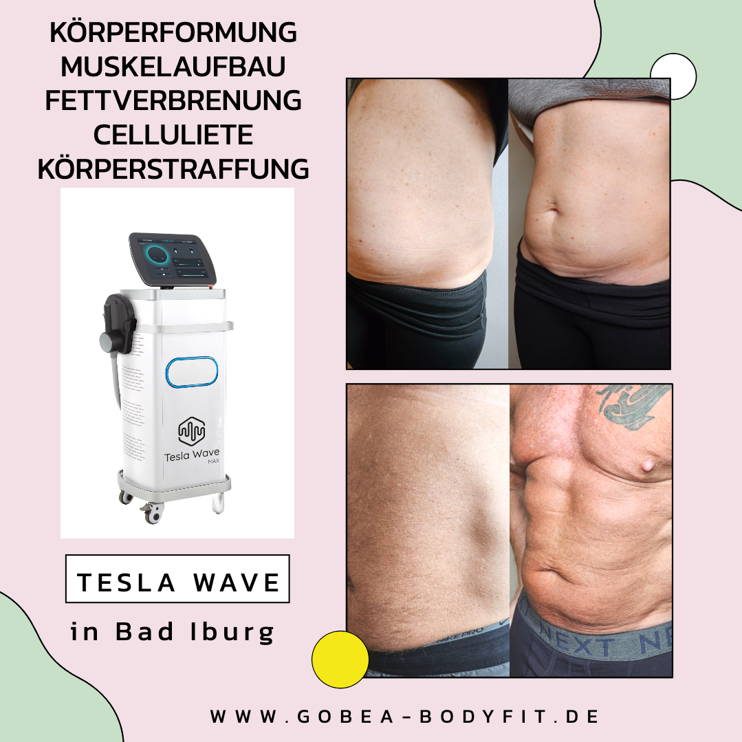 Tesla Wave – 4 Sitzungen - 350€